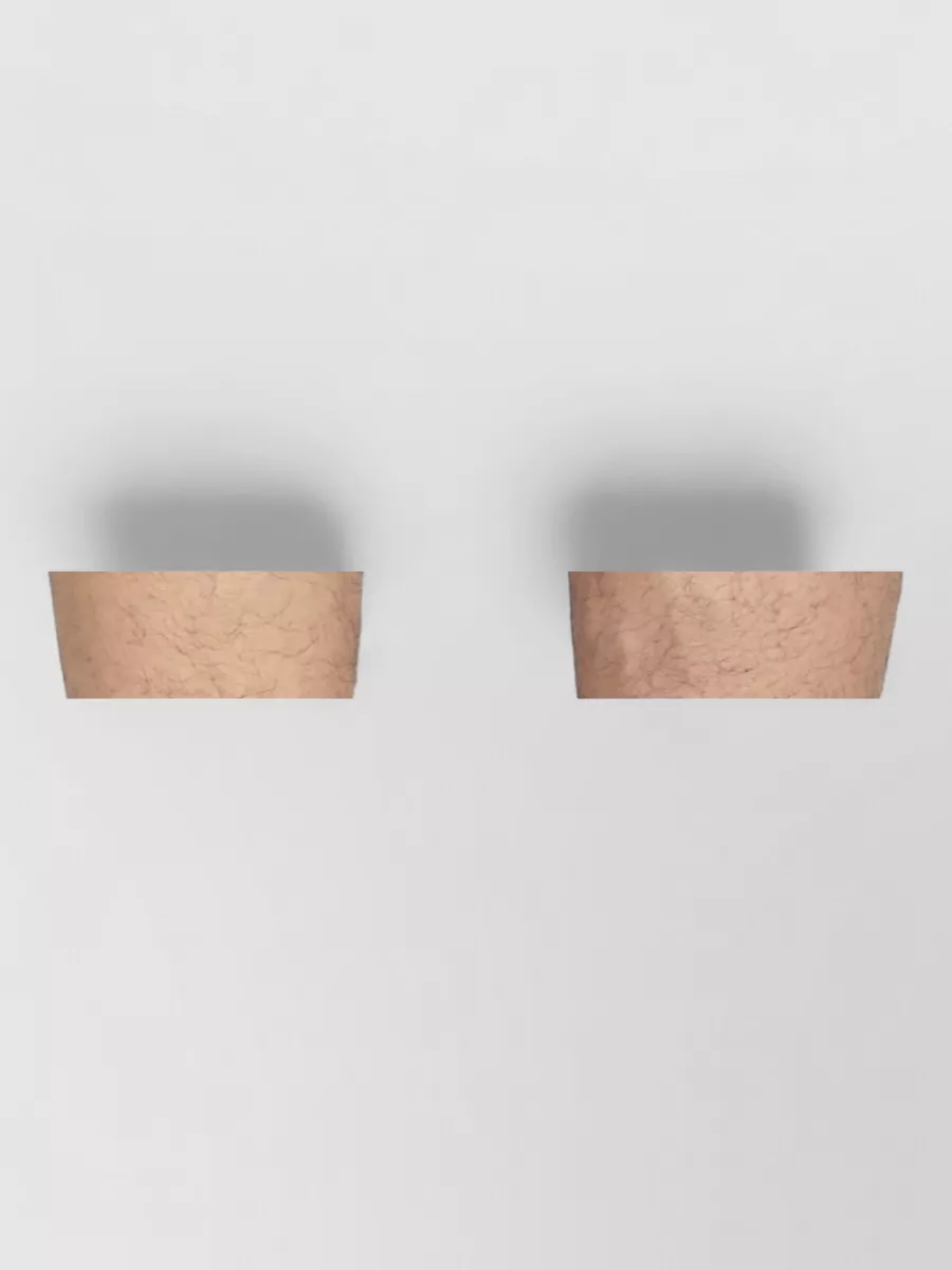 Moncler Logo Patch Swim Shorts